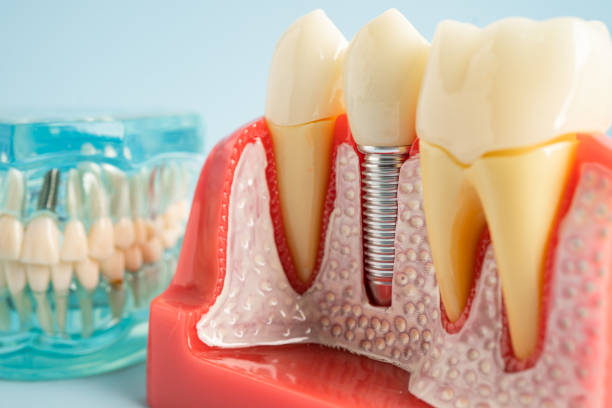 Our Range of Dental Services in South Glens Falls, NY